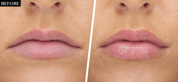 Hyaluronic Acid Lip Booster